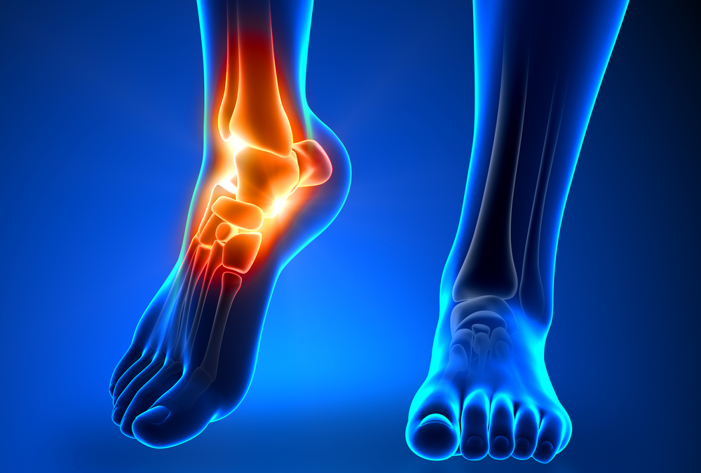 8 Things You Can Do About Foot Arthritis