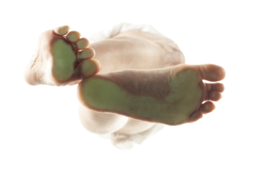 7 Ways You Could Be Making Arch Pain Worse