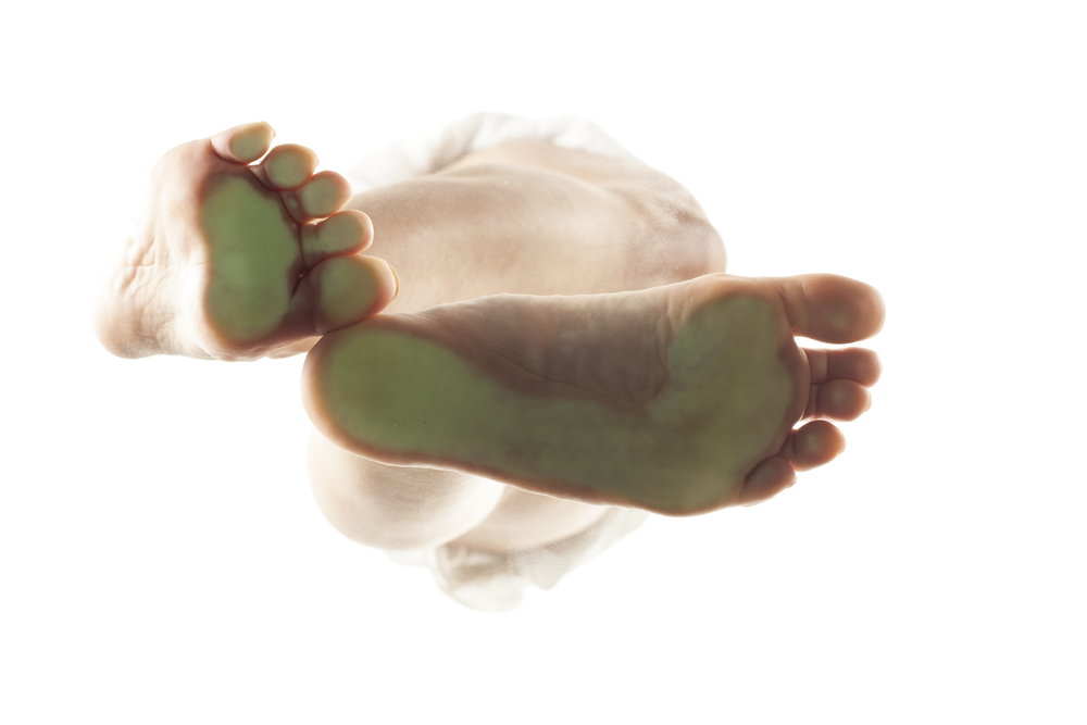 7 Ways You Could Be Making Arch Pain Worse