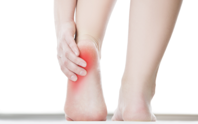 Can Achilles Bursitis Be Treated Without Surgery?